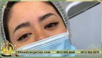 بلید ابرو بدون ترمیم