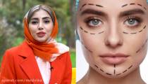زاویه سازی صورت با تزریق ژل در مشهد