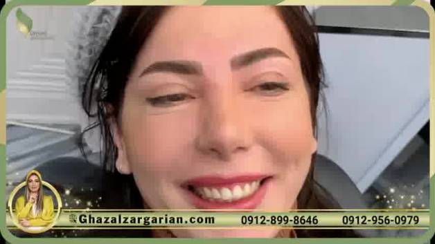 فیبروز ابرو دخترانه و طبیعی