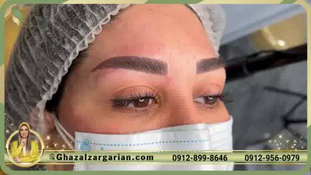 فیبروز ابرو بدون عوارض