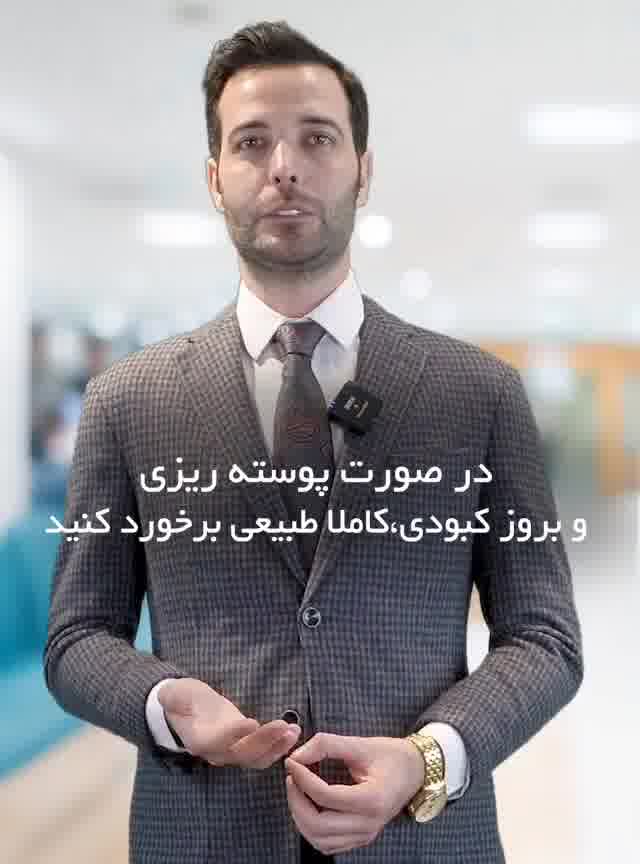 کاشت مو با روش مونوپلنت توسط دکتر کامران دلیر