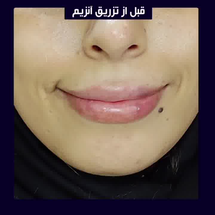 کاشت مو اصلاح خط مویی با روش  DHI  و انجام انواع خدمات زیبایی