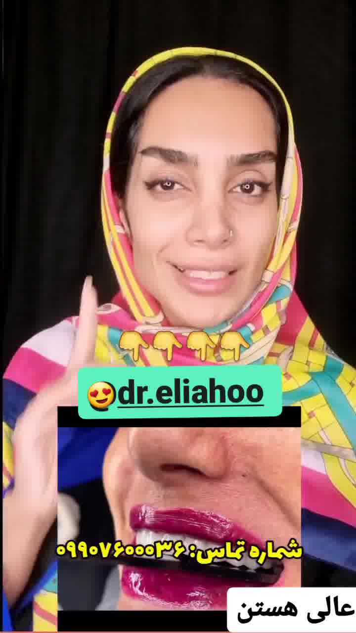 کاشت ایمپلنت در یک روز با تحویل روکش